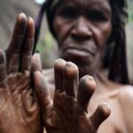 The Horrible Practice Of Finger Amputation Among Women of the Dani Tribe.