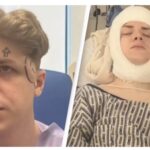 Man's Skull Removed 4 Times Just To Have His Brain Washed