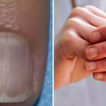 What to Watch For After Experts Issue a Warning About 'Nail Abnormalities' Associated With Cancer.