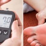 14 Symptoms of type 2 Diabetes in the Feet That Can Cause Possible Amputation