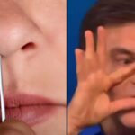 Doctor Advises Against Plucking Nose Hair to Avoid the 'Triangle of Death'