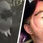 A Man Experienced Severe Facial Disfigurement After Contracting an Infection with a Mortality Rate o...