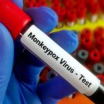 NACA Allegedly Claims That Individuals Living with HIV/AIDS Face Increased Risk of Contracting Monke...