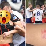 Footballer Suspended After Admitting to B!ting Opponent on the Neck