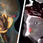 Accidental Discovery of a New Organ in the Human Body
