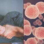 Expert Unveils: Body Twitching Could Signal Three Serious Diseases