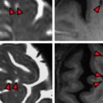 Scientists Have Mapped the Brain's Waste Disposal System for the First Time