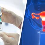 Scientists Develop World's First Ovarian Cancer Vaccine, Potentially Eliminating the Disease