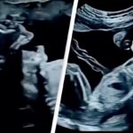 Incredible Footage Reveals What Babies Actually Do in the Womb, Leaving Viewers Amazed