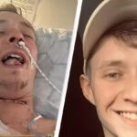Man Undergoes Tongue Removal After Ignoring a Common Cancer Warning Sign