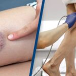 Doctors Were Surprised That Man Was Alive After He Mistook a Serious Condition for 'Pulling a Muscle...